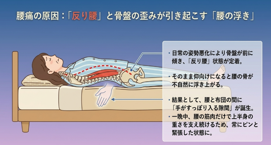 反り腰と骨盤の歪みが引き起こす「腰の浮き」